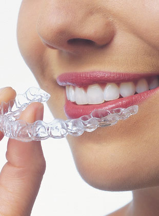 invisalign costs